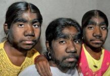 Dia Mundial das Doenças Raras: três a cada dez pessoas desconhecem as enfermidades no Brasil