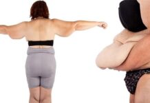 Retirada de excesso de pele após bariátrica é coberta pelo SUS e planos de saúde