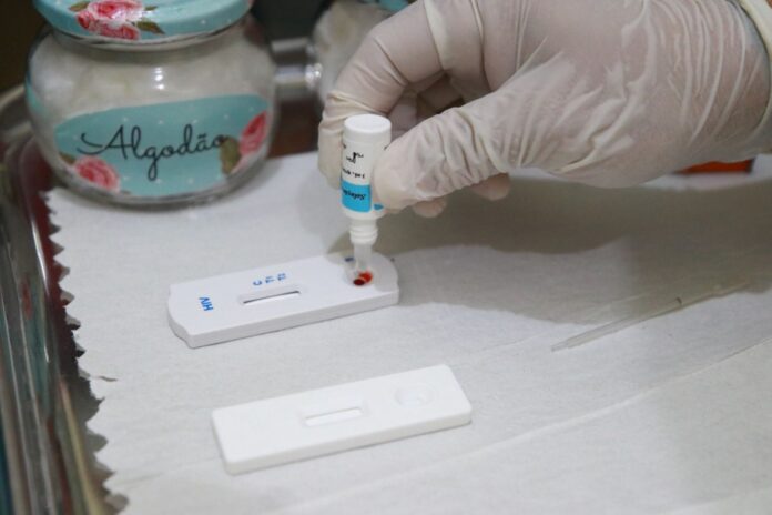 testagem HIV