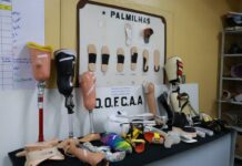Oficina ortopédica dobra atendimentos com próteses gratuitas em Manaus