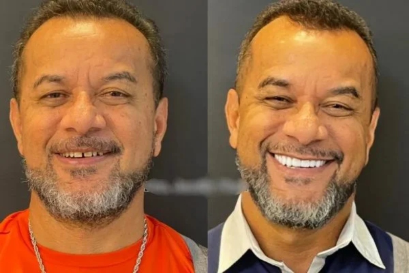 luiz-com-as-facetas-600x400