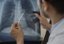 Tabagismo é maior entre jovens de 16 a 24 anos, alerta pesquisa
